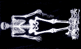Fp_026_skeleton